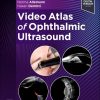 Video Atlas of Ophthalmic Ultrasound (Videos Only)