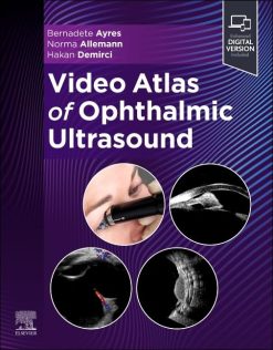 Video Atlas of Ophthalmic Ultrasound (Videos Only)