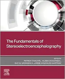 The Fundamentals of Stereoelectroencephalography (Original PDF from Publisher)