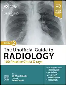 The Unofficial Guide to Radiology: 100 Practice Chest X-rays, 2nd edition (True PDF)