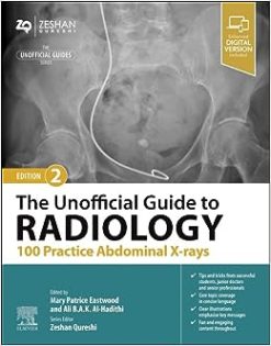 The Unofficial Guide to Radiology: 100 Practice Abdominal X-rays, 2nd edition (True PDF)