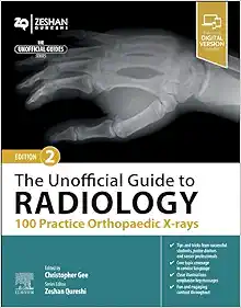 The Unofficial Guide to Radiology: 100 Practice Orthopaedic X-rays, 2nd edition (Original PDF from Publisher)