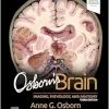 Osborn’s Brain, 3rd edition (True PDF from Publisher)