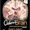 Osborn’s Brain, 3rd edition (ePub+Converted PDF)