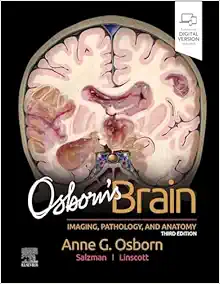 Osborn’s Brain, 3rd edition (Original PDF from Publisher)