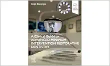 A Clinical Guide to Advanced Minimum Intervention Restorative Dentistry (True PDF from Publisher)