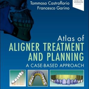 Atlas of Aligner Treatment and Planning: A Case-Based Approach (EPUB)