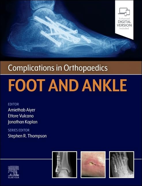 Complications in Orthopaedics: Foot and Ankle (True PDF)
