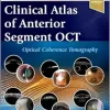 Clinical Atlas of Anterior Segment OCT: Optical Coherence Tomography (ePub+Converted PDF)