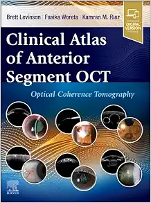 Clinical Atlas of Anterior Segment OCT: Optical Coherence Tomography (Original PDF from Publisher)