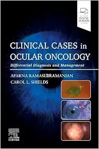 Clinical Cases in Ocular Oncology: Differential Diagnosis and Management (Original PDF from Publisher)