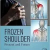 Frozen Shoulder: Present and Future (EPUB)