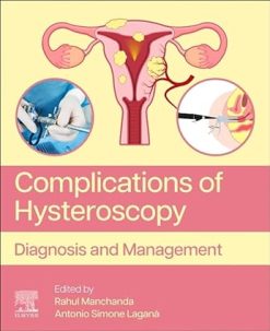Complications of Hysteroscopy: Diagnosis and Management (Original PDF from Publisher)