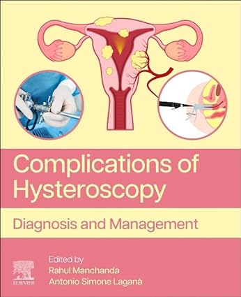 Complications of Hysteroscopy: Diagnosis and Management (Original PDF from Publisher)