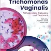 Trichomonas vaginalis: Pathogenesis, Diagnosis, and Treatment (True PDF from Publisher)