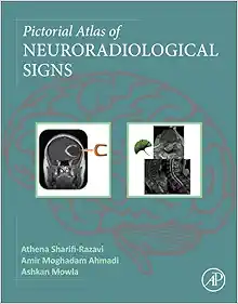 Pictorial Atlas of Neuroradiological Signs (EPUB)