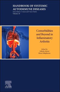 Inflammatory Arthritis Beyond the Joints: Comorbidities and other Manifestations (Handbook of Systemic Autoimmune Diseases, Volume 18) (True PDF from Publisher)