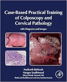 Case-Based Practical Training of Colposcopy and Cervical Pathology: With Diagrams and Images (Original PDF from Publisher)
