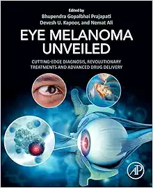 Eye Melanoma Unveiled: Cutting-Edge Diagnosis, Revolutionary Treatments and Advanced Drug Delivery (True PDF from Publisher)