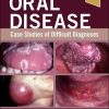 Oral Disease: Case Studies of Difficult Diagnoses (EPUB)