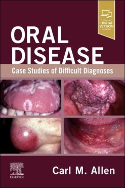 Oral Disease: Case Studies of Difficult Diagnoses (EPUB)