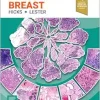 Diagnostic Pathology: Breast, 4th edition (EPUB)