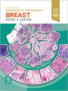 Diagnostic Pathology: Breast, 4th edition (EPUB)