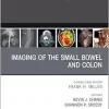 Imaging of the Small Bowel and Colon, An Issue of Radiologic Clinics of North America (Volume 63-3) (The Clinics: Radiology, Volume 63-3) (EPUB)