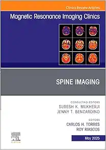Spine Imaging, An Issue of Magnetic Resonance Imaging Clinics of North America (Volume 33-2) (The Clinics: Radiology, Volume 33-2) (True PDF from Publisher)
