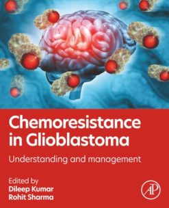 Chemoresistance in Glioblastoma: Understanding and Management (True PDF from Publisher)