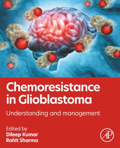 Chemoresistance in Glioblastoma: Understanding and Management (True PDF from Publisher)