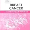 Breast Cancer: A Multidisciplinary Approach: Clinics Collections (Volume 14 -1) (ePub+Converted PDF)