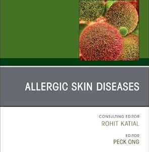 Allergic Skin Diseases, An Issue of Immunology and Allergy Clinics of North America (Volume 45-4) (EPUB)