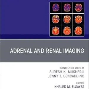 Adrenal and Renal Imaging, An Issue of Magnetic Resonance Imaging Clinics of North America (Volume 33-4) (The Clinics: Radiology, Volume 33-4) (EPUB)
