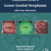 Comprehensive review of lower genital neoplasms: With case discussion (True PDF from Publisher)
