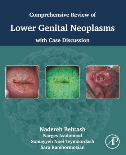 Comprehensive review of lower genital neoplasms: With case discussion (True PDF from Publisher)