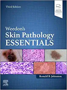 Weedon’s Skin Pathology Essentials, 3rd edition (True PDF)