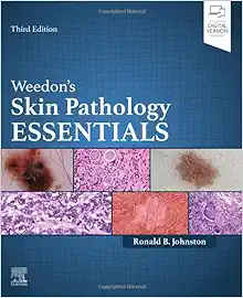Weedon’s Skin Pathology Essentials, 3rd edition (Original PDF from Publisher)