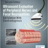 Ultrasound Evaluation of Peripheral Nerves and Focal Neuropathies, 2nd Edition: Correlation With Electrodiagnosis (EPUB)