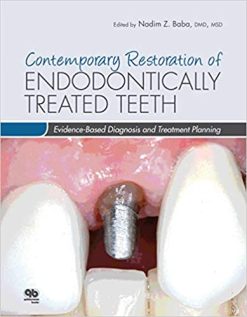 Contemporary Restoration of Endodontically Treated Teeth: Evidence-Based Diagnosis and Treatment Planning (ORIGINAL PDF from Publisher)