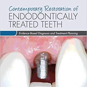 Contemporary Restoration of Endodontically Treated Teeth: Evidence-Based Diagnosis and Treatment Planning (ORIGINAL PDF from Publisher)