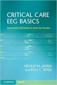 Critical Care EEG Basics: Rapid Bedside EEG Reading for Acute Care Providers (Original PDF from Publisher)