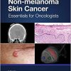 Non-melanoma Skin Cancer: Essentials for Oncologists (Original PDF from Publisher)