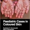 Paediatric Cases in Coloured Skin (Original PDF from Publisher)