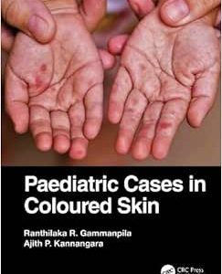 Paediatric Cases in Coloured Skin (Original PDF from Publisher)