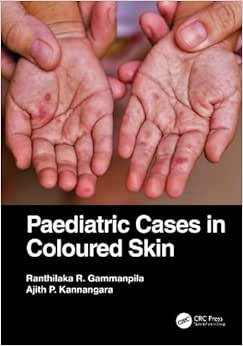 Paediatric Cases in Coloured Skin (Original PDF from Publisher)