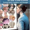 Medical Illustration in the Courtroom: Proving Injury, Causation, and Damages (Original PDF from Publisher)