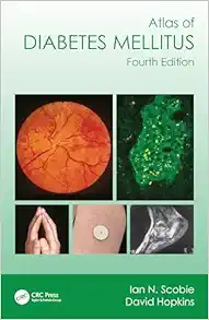 Atlas of Diabetes Mellitus, 4th edition (Original PDF from Publisher)