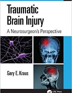 Traumatic Brain Injury: A Neurosurgeon’s Perspective (Original PDF from Publisher)