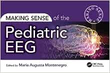 Making Sense of the Pediatric EEG (Original PDF from Publisher)